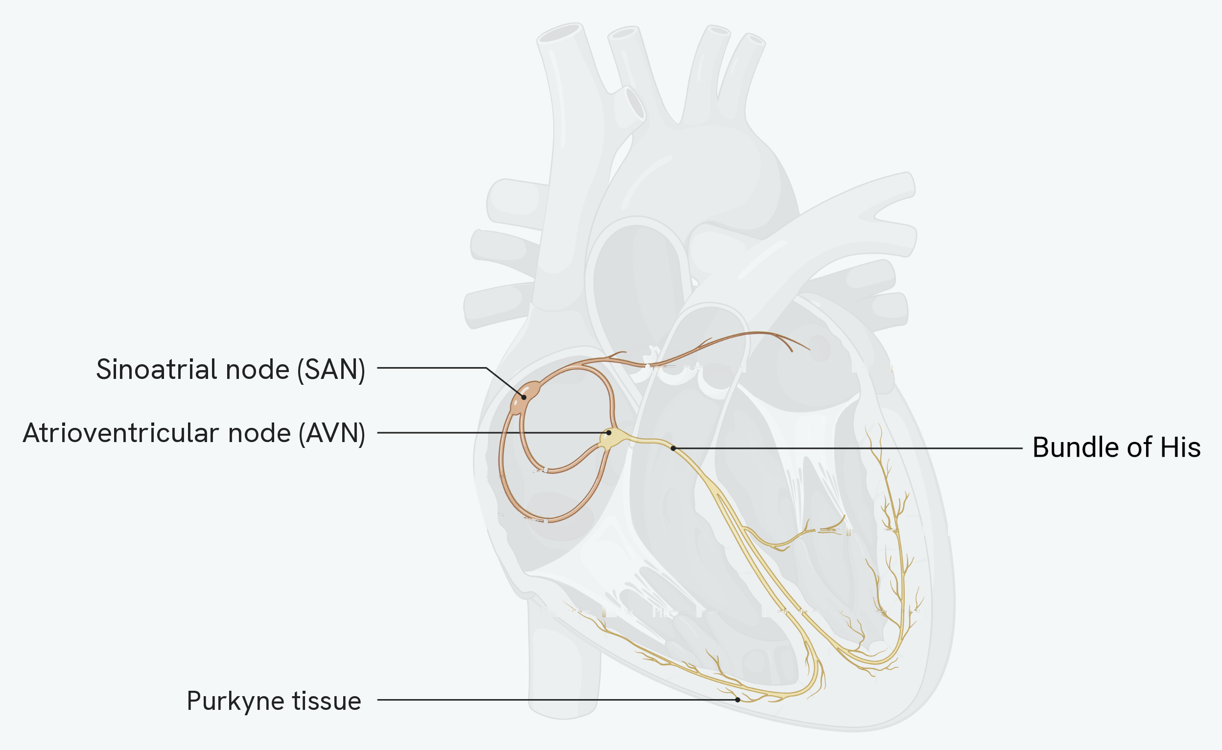The conducting system of the heart, drawn on a cut-away heart. The sinoatrial node sits in the wall of the right atrium, with the wave of electrical activity spreading across both atria. The atrioventricular node sits between the atria and the ventricles, and the bundle of His runs down from it through the septum towards the apex, where it divides into the finer Purkyne tissue that spreads back up through the ventricle walls