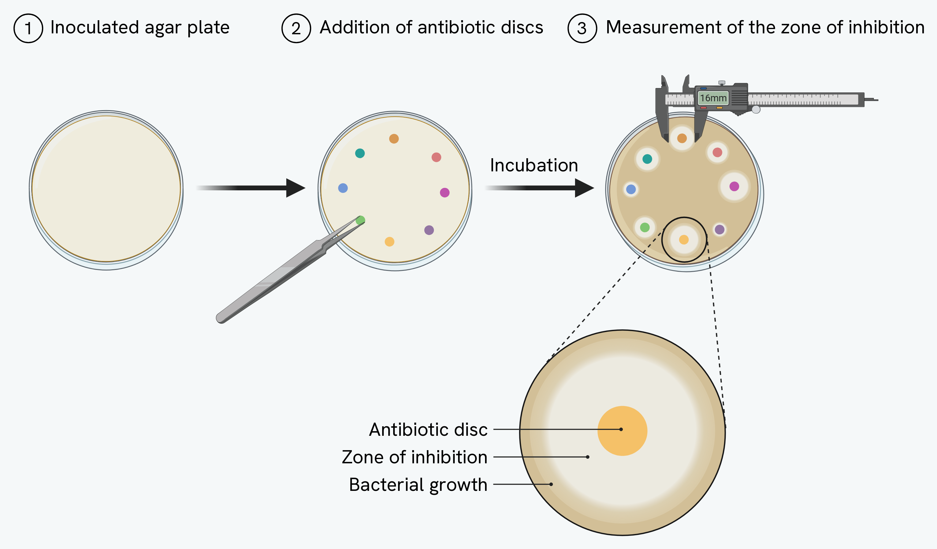 Testing antibiotics in three steps. 1, an agar plate inoculated with a lawn of bacteria. 2, paper discs soaked in different antibiotics are placed on the agar with sterilised forceps. 3, after incubation the plate is covered in bacterial growth except for a clear zone of inhibition around each disc, and the diameter of a zone is measured with callipers. One disc is enlarged to show the antibiotic disc at the centre, the clear zone of inhibition around it, and the bacterial growth beyond